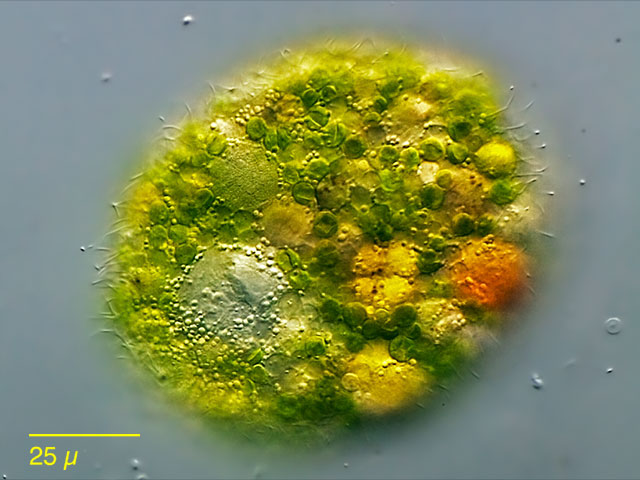 Leben im Teich Längliche Zahnwalze (Holophrya ovum) Wimpertiere (Ciliata)