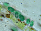 kirchneriella_sp1c