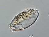 acanthocystis__sp.2l