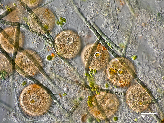 Stefansbachtal Gevelsberg Leben im Teich Einzeller (Protista)Juwelen