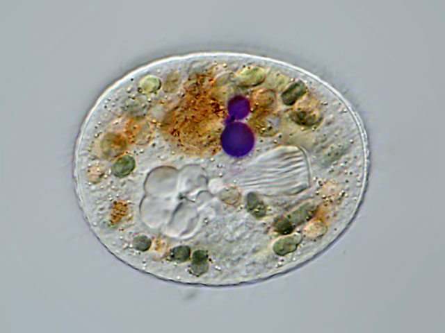 Stefansbachtal Gevelsberg Leben im Teich Einzeller (Protista)Juwelen