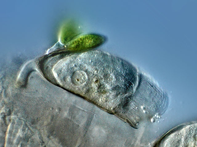 plingfactory Leben im Teichdas Beringte Pokaltierchen (Cothurnia