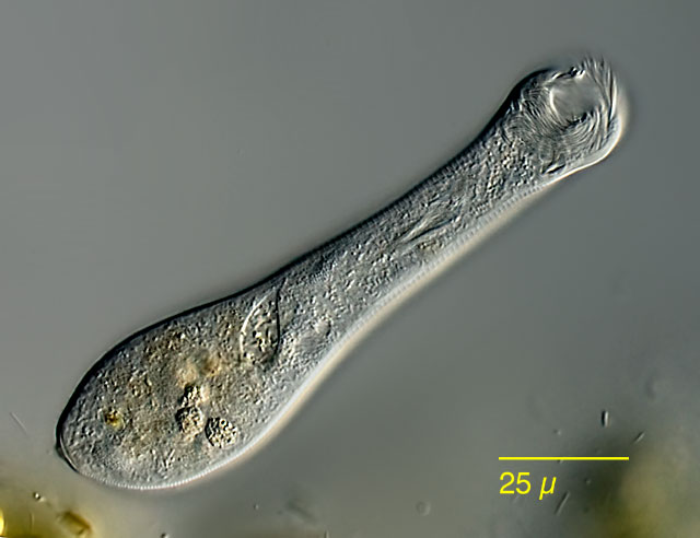 Leben im Teich Gerda crassicaule, Peritricha, Ciliata, Protista