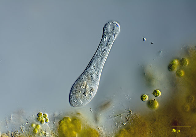 Leben im Teich Gerda crassicaule, Peritricha, Ciliata, Protista