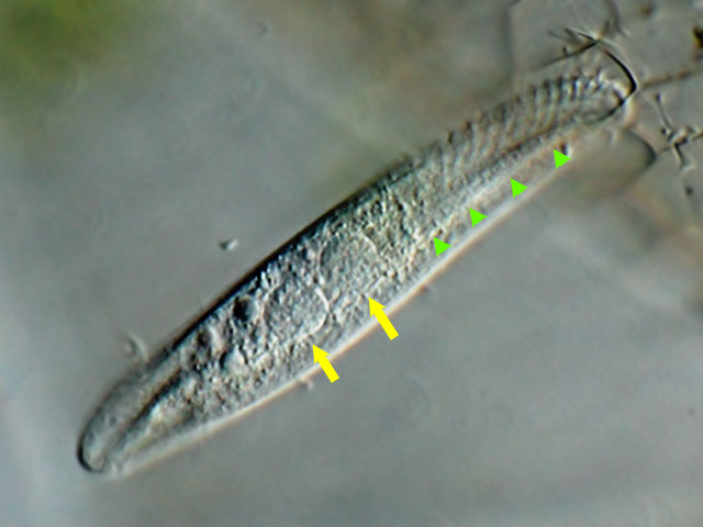 Leben im Teich Litonotus lamella, Pleurostomatidae, Ciliata, Protista