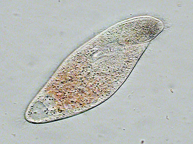Stefansbachtal Gevelsberg Leben im Teich Einzeller (Protista) Helm
