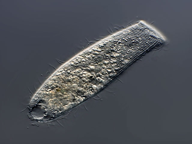 Freshwater and other from Germany Spathidium cf