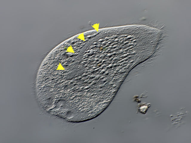 Freshwater and other from Germany Spathidium cf