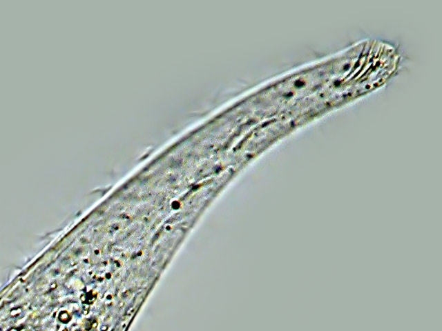 Stefansbachtal Gevelsberg Leben im Teich Einzeller (Protista