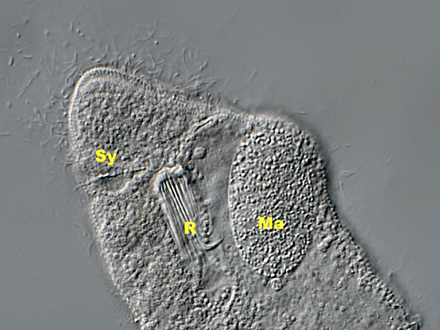 Stefansbachtal Gevelsberg Leben im Teich Einzeller (Protista)Juwelen