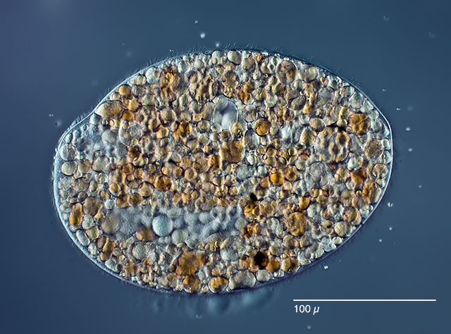 Stefansbachtal Gevelsberg Leben im Teich Einzeller (Protista