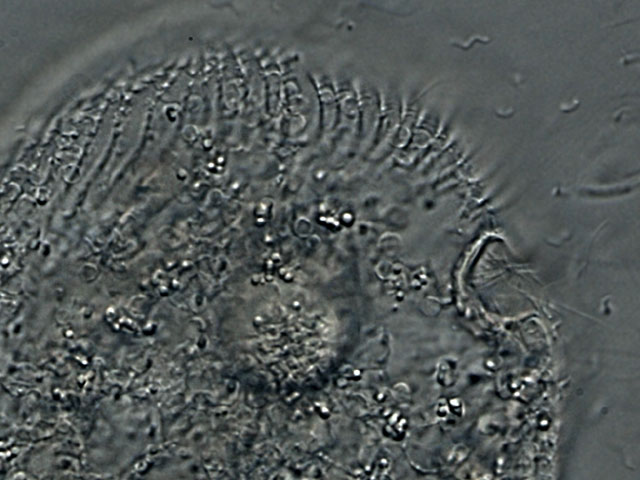 Stefansbachtal Gevelsberg Leben im Teich Einzeller (Protista