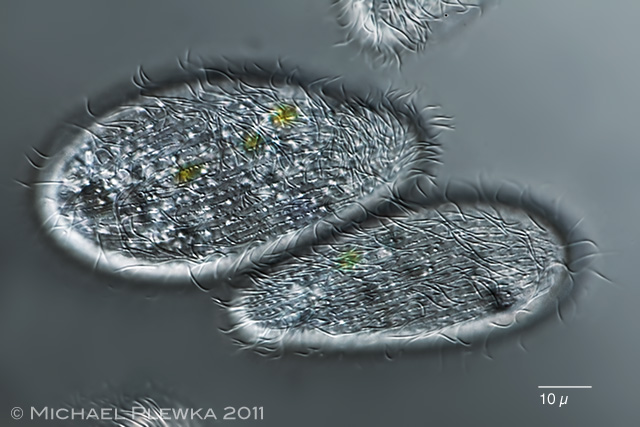 Stefansbachtal Gevelsberg Leben im Teich Einzeller (Protista