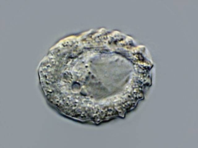 Leben im Teich Chilodonella gouraudi, Cyrtophorida, Ciliata, Protista