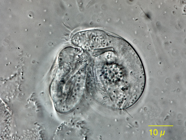 Leben im Teich das Rädertier TeleskopRädertier Rotaria sp. (Rotatoria