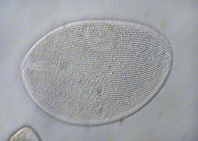 Leben im Teich Längliche Zahnwalze (Holophrya sp.) Wimpertiere (Ciliata)