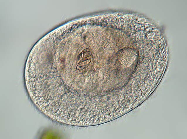 Leben im Teich Längliche Zahnwalze (Holophrya sp.) Wimpertiere (Ciliata)