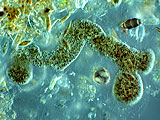 acanthocystis__sp.2l