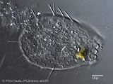 nebela tincta protists