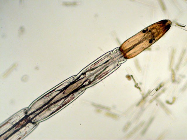 Bezzia, larve de diptère nématocère aquatique - CANAL 