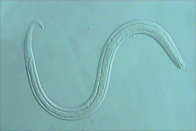 https://www.plingfactory.de/Science/Atlas/KennkartenTiere/Nematoda/image/nematode_3c.jpg