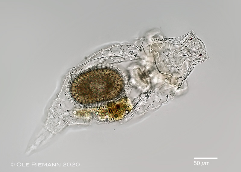 A female rotifer (Rhinoglena frontalis) carrying a resting egg.