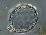 acanthocystis__sp.2l